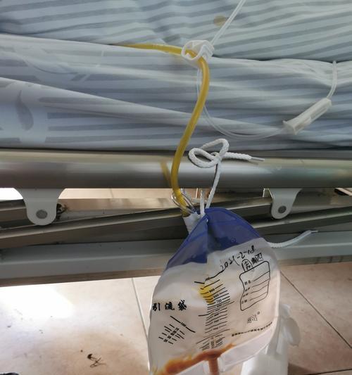 狗腹腔积液的症状及相关信息（探究狗腹腔积液的主要表现和治疗方法）