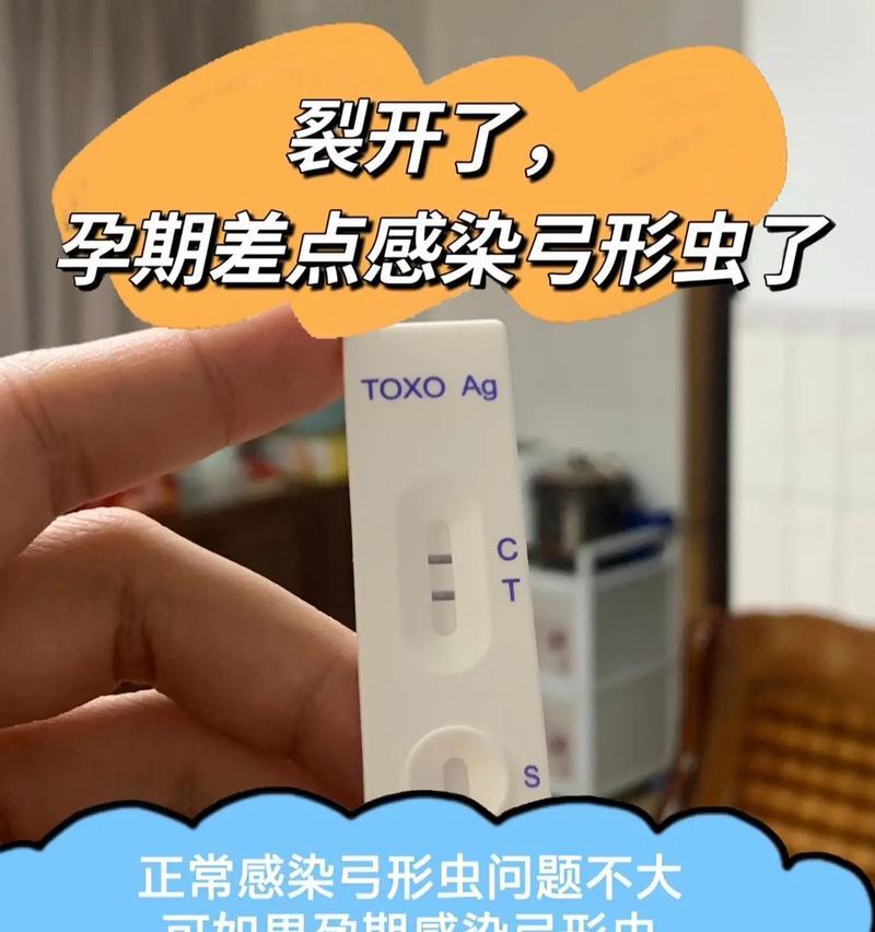 猫感染弓形虫（了解猫感染弓形虫的治愈时间和关键因素）