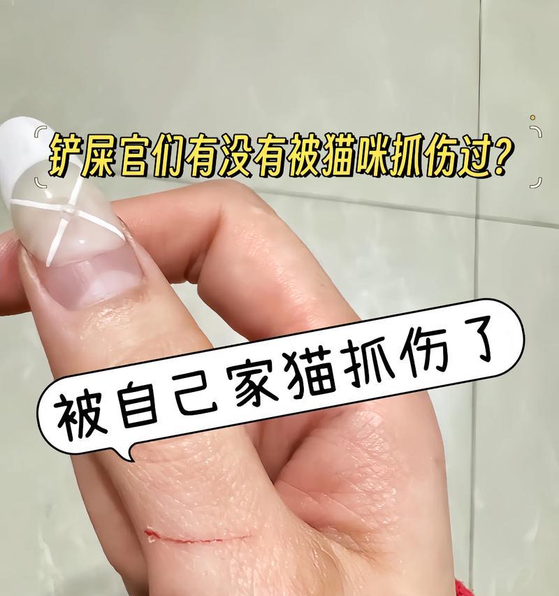 猫抓伤后打狂犬疫苗的有效期（猫抓伤后多长时间内打狂犬疫苗有效？）