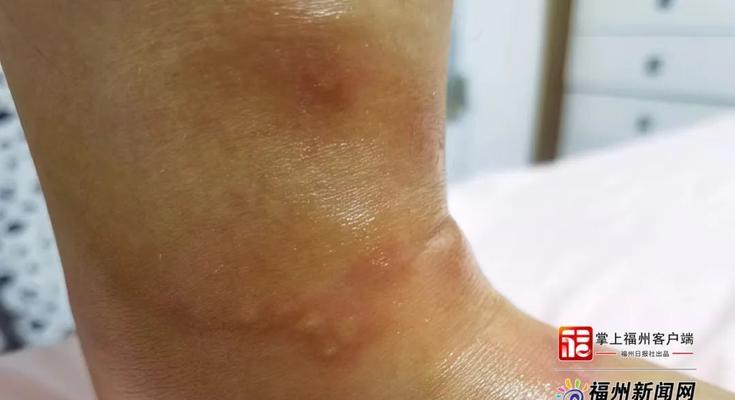 “微型杀手（小身躯中蕴藏致命威胁，这只是个开始）