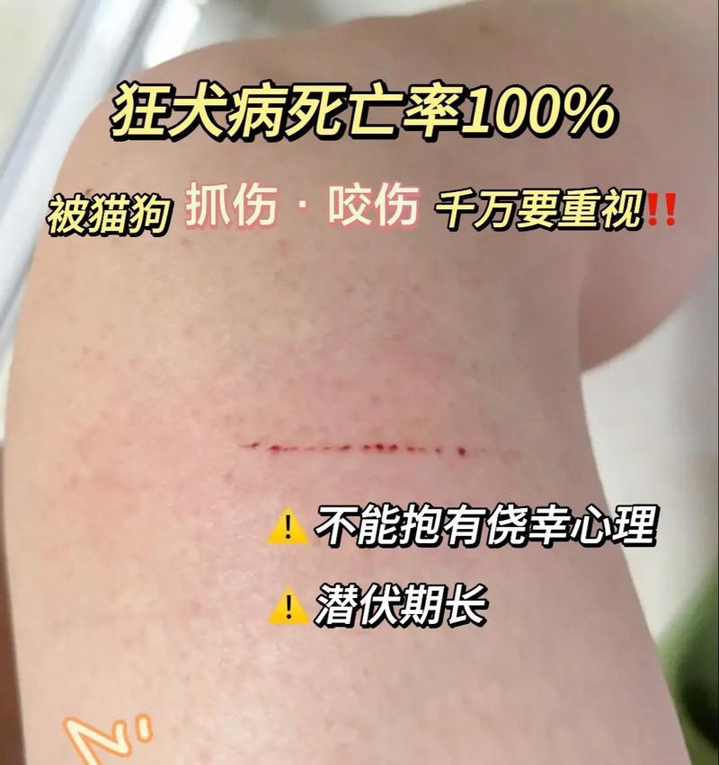 狂犬病病毒在物体上的存活时间研究（探究狂犬病毒在不同物体表面的存活能力和传播风险）