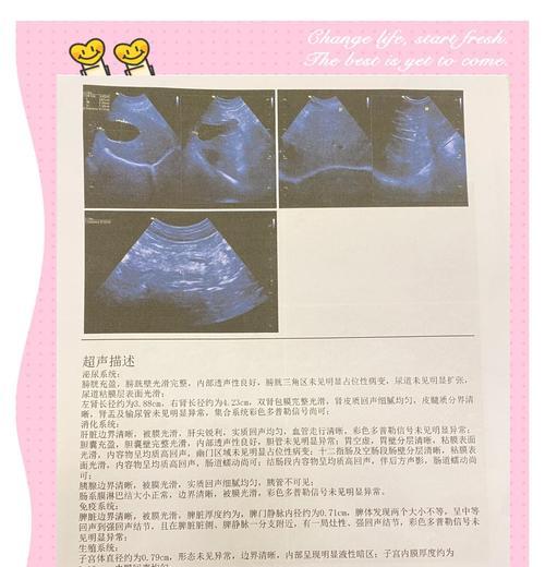 狗狗手术康复的时间和注意事项（了解狗狗手术康复期，让爱宠更快恢复健康）