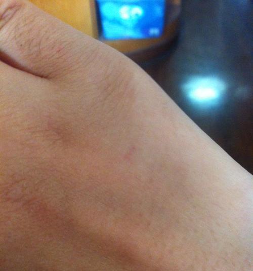 狗疫苗保护的关键-正确接种时间（狗疫苗接种时间的重要性及建议）