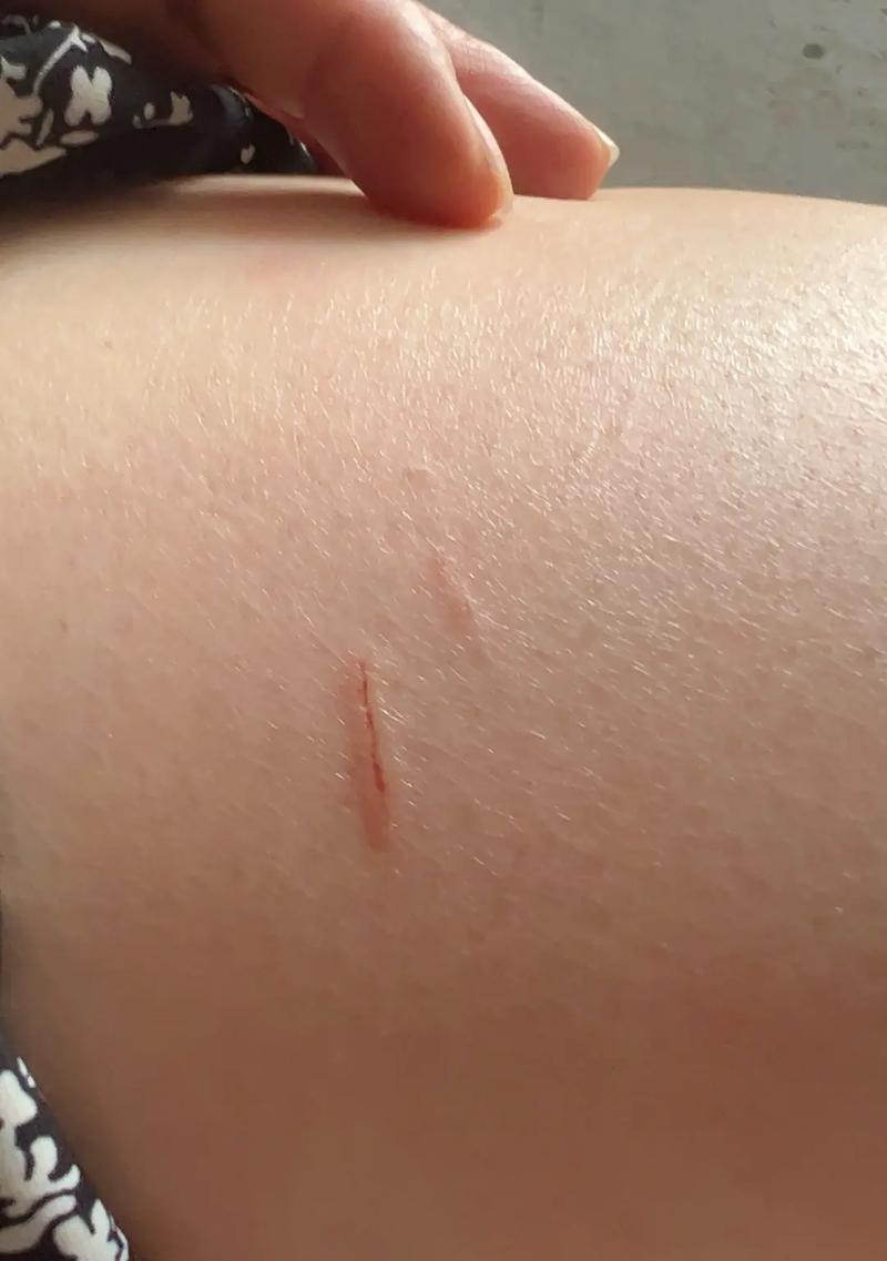 宠物猫被抓到后需要打疫苗的时间与注意事项（养猫人必读！猫咪抓伤后的疫苗接种时间表及注意事项）