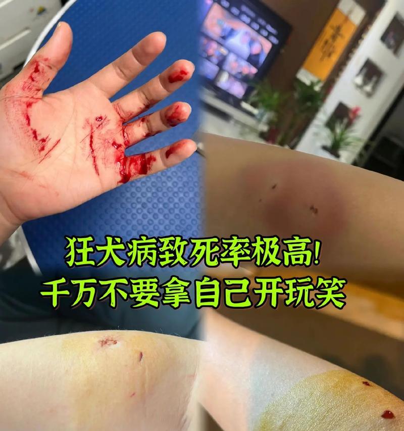 狂犬病（揭开狂犬病真相，保护我们的毛茸伙伴）
