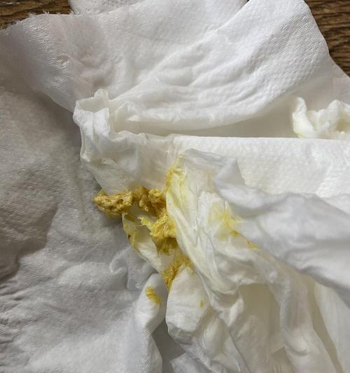 奶猫的排便频率及注意事项（掌握奶猫的排便规律，确保它们的健康成长）