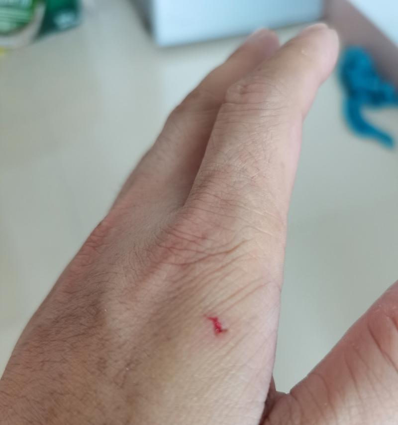 兔子携带狂犬病（兔子携带狂犬病的危害及预防方法）